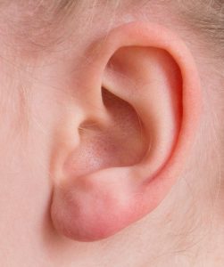 The ear